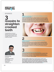 3 reasons to straighten crooked teeth